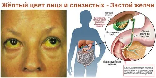 як прибрати гіркота в роті вранці після їжі що робити причини лікування позбутися чому допоможе аллохол