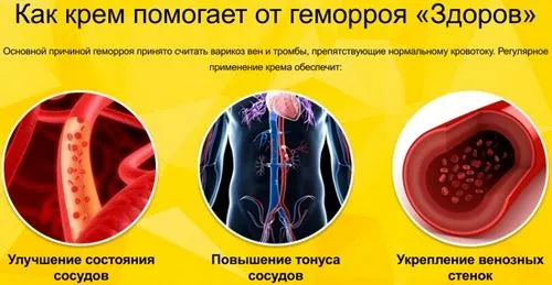 вилікувати геморой раз і назавжди