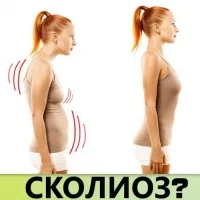 як вилікувати викривлення спини