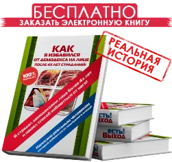 як вилікувати демодекс назавжди