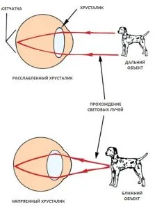 вилікувати короткозорість будинку