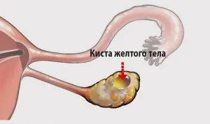 онкологічна панель
