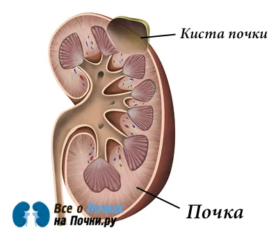 лікування