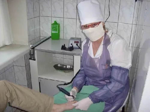 грибок ноги лікування симптоми ознаки як визначається передається
