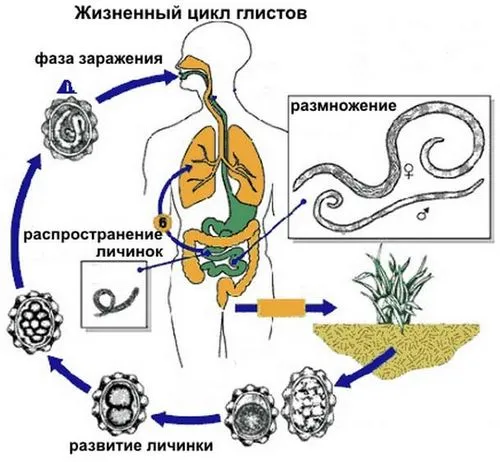 лікувати глисти людини