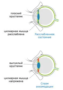як лікувати помилкову короткозорість