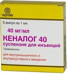 як лікувати остеоартроз колінного суглоба