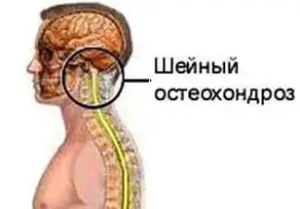 симптоми