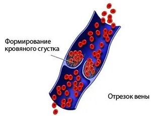 лікування