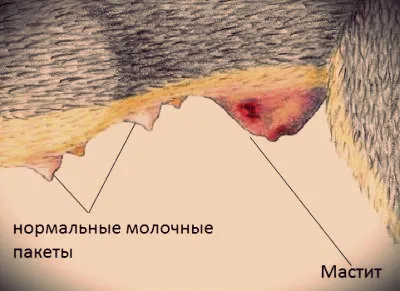 як лікувати мастит антибіотики