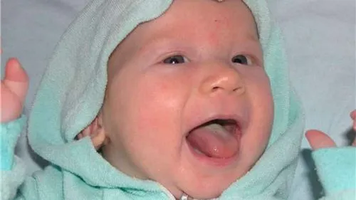 як лікувати обкладений язик