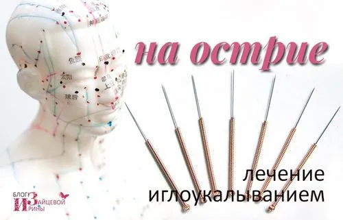 голковколювання. лікування. користь і шкода. протипоказання. відгуки