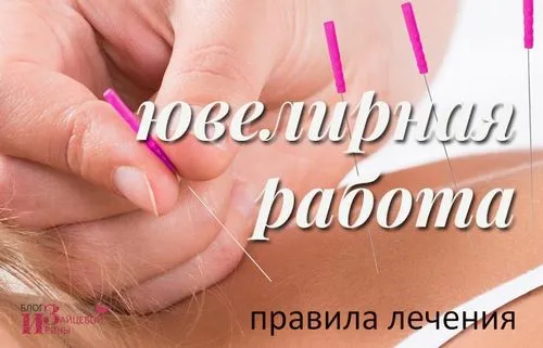 чи можна вилікувати алергію акупунктурою