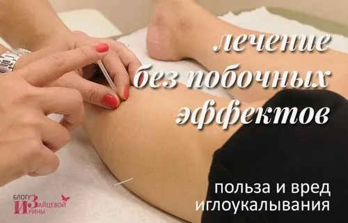 чи можна вилікувати алергію акупунктурою