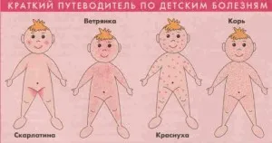 як лікувати інфекційний дерматит