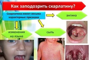 як лікувати інфекційний дерматит