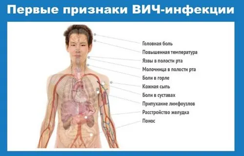 Перші ознаки і симптоми сніду чи можна вилікувати захворювання вич