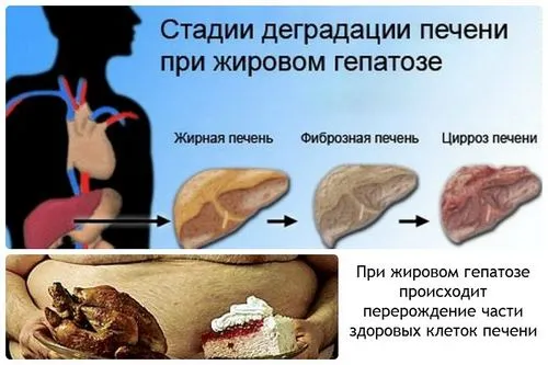 як лікувати печінку від ожиріння