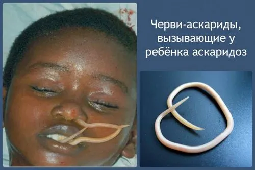 як лікувати лямблії і аскариди