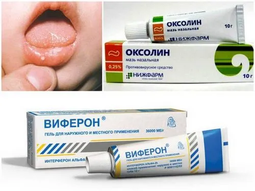 як лікувати стоматит мазі