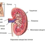 сольовий діатез нирок