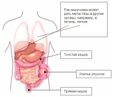 симптоми