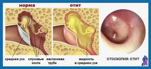втрата