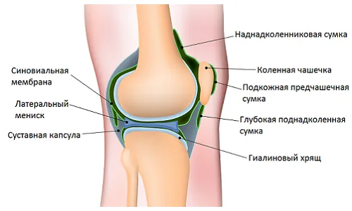 як лікувати препателлярний бурсит