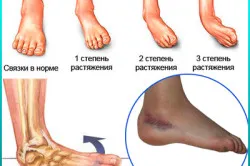 здорові стопи