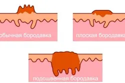 здорові стопи