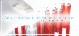 як лікувати пневмонію без кашлю і температури