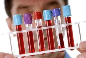 як лікувати сечовий міхур від застуди