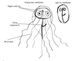 як лікувати лямблії в жовчному міхурі