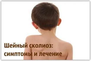 як лікувати викривлення шиї