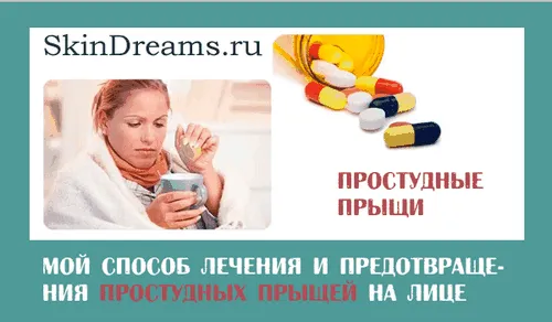 Простудні прищі на обличчі, мій спосіб лікування і запобігання як лікувати прищі від холоду