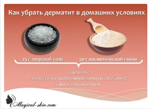 себорейний дерматит лікування шкіра тіло фото позбутися заразний причина виникнення симптом народний засіб рука хвороба препарат курс лишай з'являється передається людина спина змішана груди метод