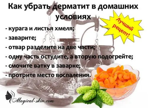 себорейний дерматит обличчя лікування фото суха мазь відгук народний засіб жирна рідка шкіра лоба жінка яблучний оцет причина виникнення