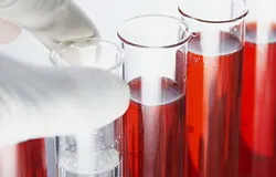 нейропатія