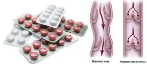 Таблетки від варикозу вен на ногах як лікувати розтягнення вен