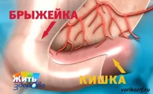 як лікувати тромбоз кишечника