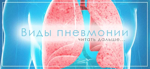 як лікувати крупозную пневмонію