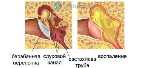 як лікувати коли вуха стріляють