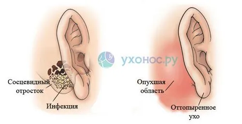 як лікувати коли вуха стріляють