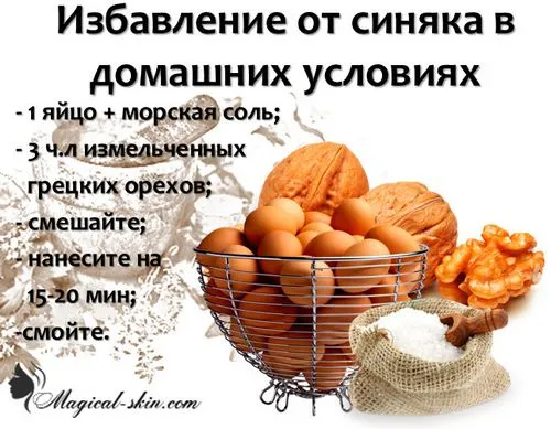 як вилікувати синяк на попі