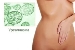 як лікувати уреаплазмоз при вагітності