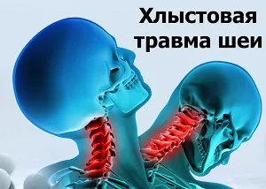 травми хлиста