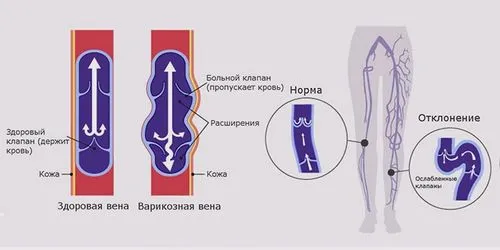 причини