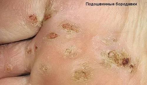 принципи лікування