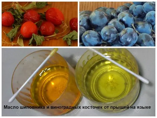 як лікувати прищі на мові в домашніх умовах