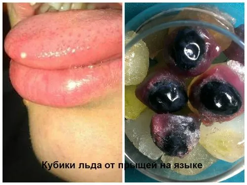 прищ на мові